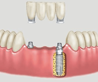 Clínica Odontológica ArtenDentes